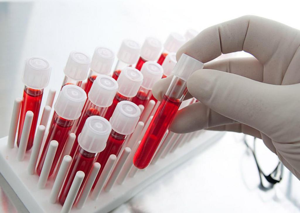 Биохимический анализ крови – наиболее точный метод выявления аллергенов в организме