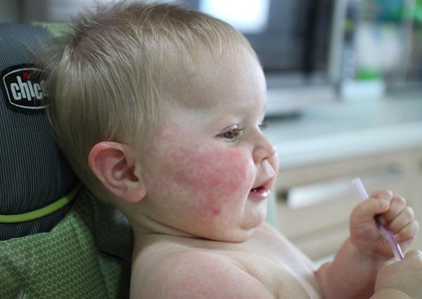 Ребенок 2 месяца температура без симптомов thumbnail