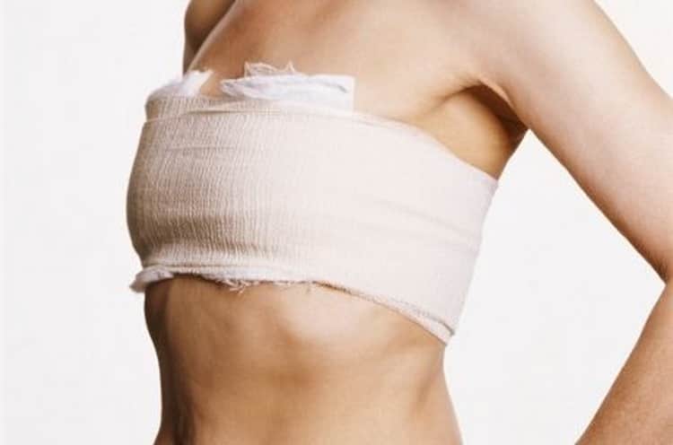 Перевязывание груди – не самый лучший способ прекратить ГВ