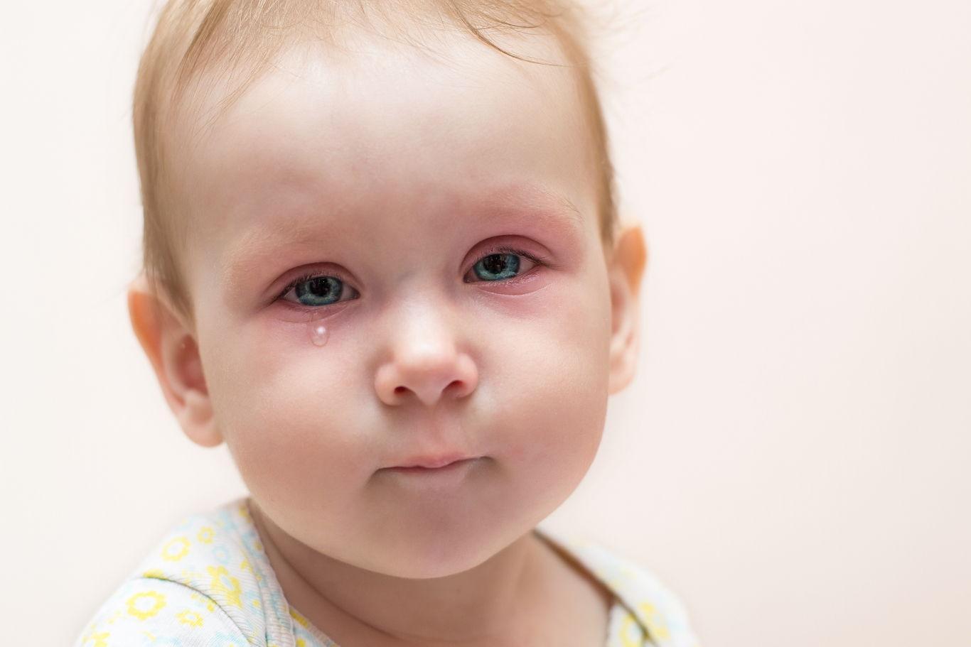 Аллергия на гречневую кашу у ребенка thumbnail
