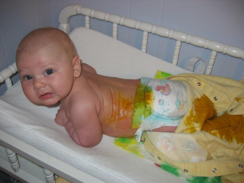 Жидкий стул и температура новорожденного ребенка thumbnail