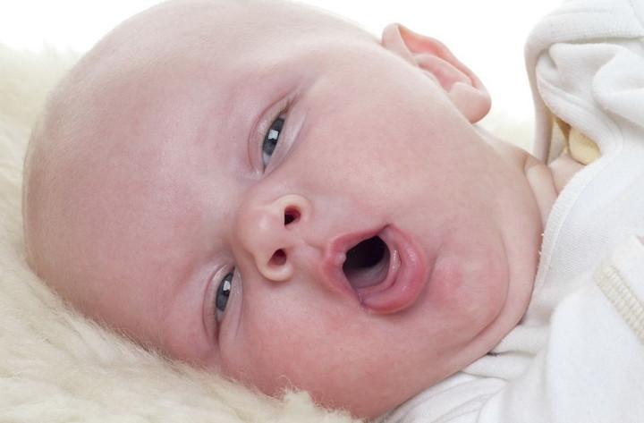 У ребенка сопли кашель и чихает без температуры thumbnail
