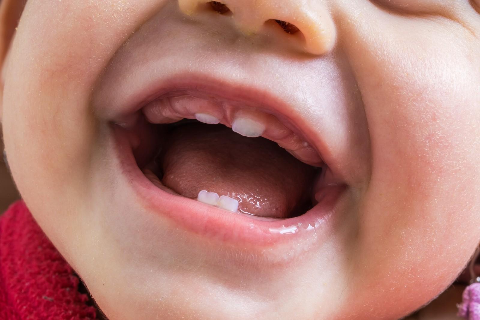 У ребенка в 1 год нет зубов вообще thumbnail