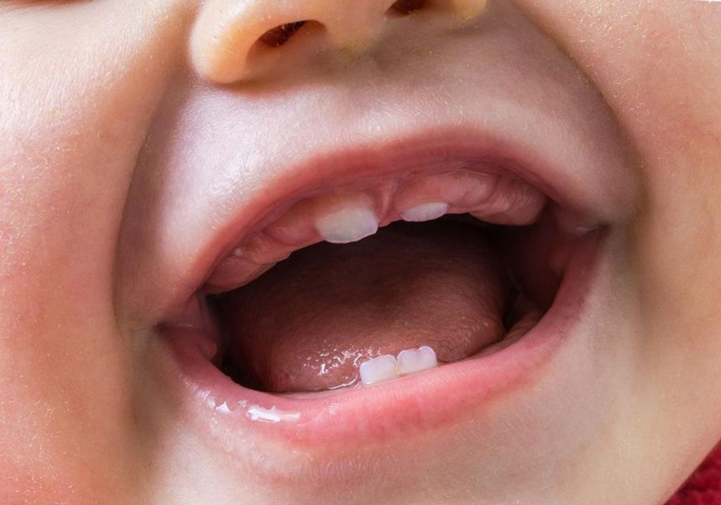 Что может быть у детей при прорезывании зубов сколько дней и какая thumbnail