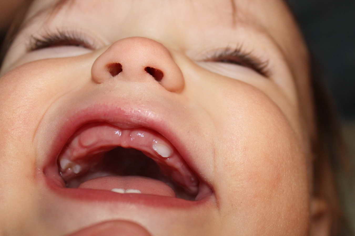 Сколько длится понос у ребенка когда лезут зубы thumbnail
