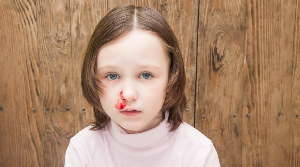 Ребенка в 1 год и 3 месяца пошла кровь из носа thumbnail
