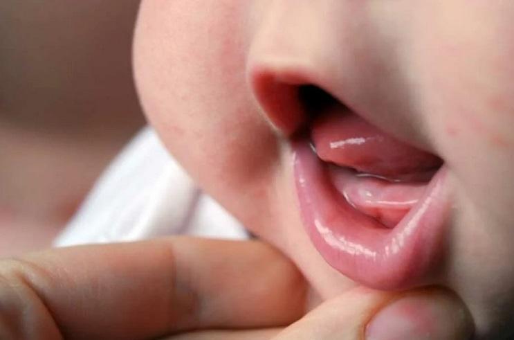 Рвота у ребенка и температура при прорезывании зубов thumbnail