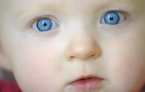 Отеки глаз у малышей в 7 месяцев thumbnail