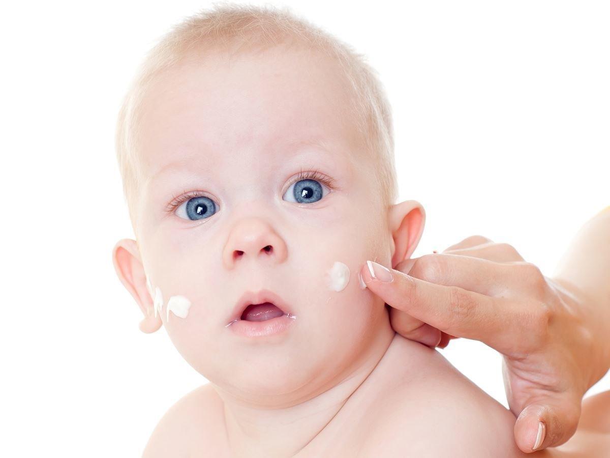 Что делать если у ребенка аллергия на щеках thumbnail