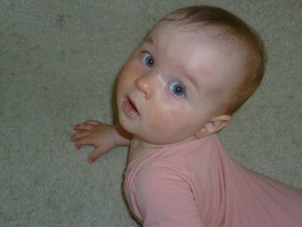У ребенка на переносице синяя венка 2 года thumbnail