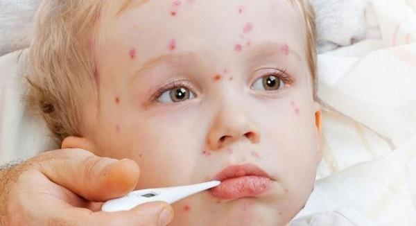 Аллергия у ребенка все тело в красных пятнах thumbnail