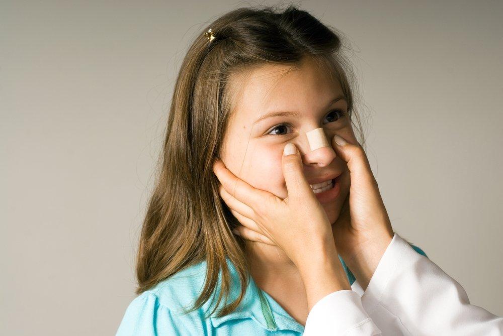 Признак перелома носа у ребенка thumbnail