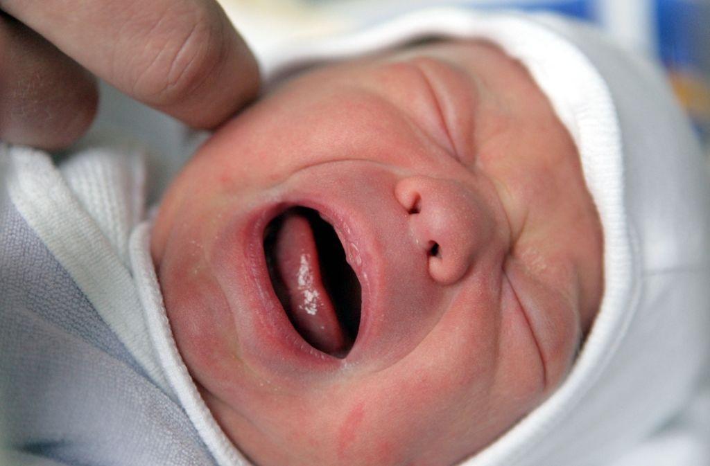 Синева вокруг рта у ребенка 1 год thumbnail